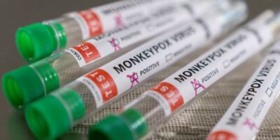 SP capacita profissionais para cuidados com a varíola dos macacos