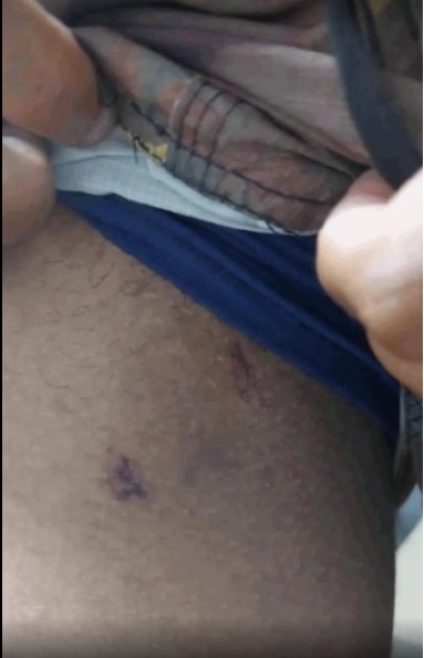 Vereador morde a virilha de um torcedor do Flamengo… virilha?!