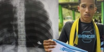 Fragmento de fuzil é encontrado no corpo de jovem