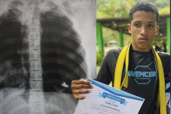 Fragmento de fuzil é encontrado no corpo de jovem