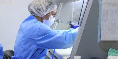 Ministério da Saúde confirma primeira morte por varíola dos macacos no Brasil