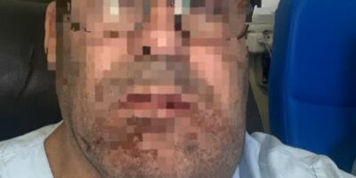 Empresário brasileiro é brutalmente agredido por integrantes de gangue em Portugal