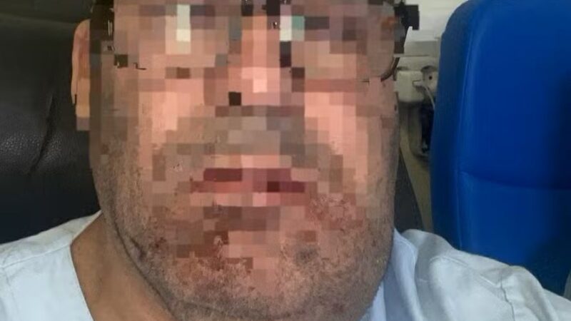 Empresário brasileiro é brutalmente agredido por integrantes de gangue em Portugal